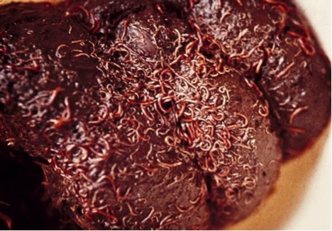 Let's do it naturally!